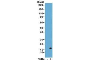 Western Blot of acid extracts from human HeLa cells untreated (-) or treated (+) with sodium butyrate using the recombinant H3K14ac antibody at 0. (Rekombinanter Histone 3 Antikörper  (acLys14))