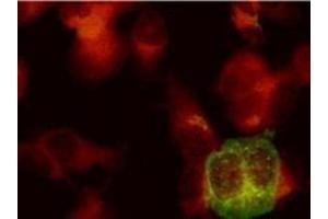 Immunofluorescence (IF) image for anti-Herpes Simplex Virus Type 2, Glycoprotein E (HSV2 gE) antibody (ABIN265568) (HSV-2 gE Antikörper)
