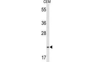 Western blot analysis of TIFA Antibody (N-term) in CEM cell line lysates (35 µg/lane). (TIFA Antikörper  (N-Term))