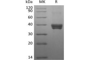 Western Blotting (WB) image for C-Type Lectin Domain Family 4, Member M (CLEC4M) protein (ABIN7319881)