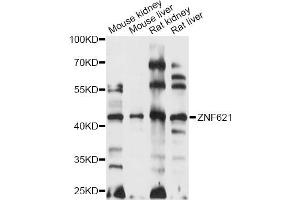 Western blot analysis of extracts of various cell lines, using ZNF621 antibody (ABIN6291114) at 1:1000 dilution. (ZNF621 Antikörper)