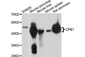Western blot analysis of extracts of various cell lines, using CPB1 antibody (ABIN4903360) at 1:1000 dilution. (CPB1 Antikörper)