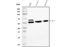 Western blot analysis of PTBP2 using anti-PTBP2 antibody (ABIN7599453).