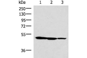 Western blot analysis of HepG2 K562 and A172 cell lysates using TTC38 Polyclonal Antibody at dilution of 1:1000 (TTC38 Antikörper)