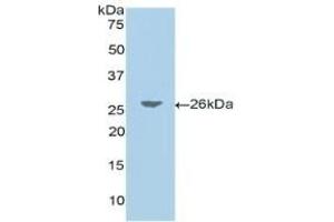 Detection of Recombinant JAG1, Human using Polyclonal Antibody to Jagged 1 (JAG1) (JAG1 Antikörper  (AA 33-250))