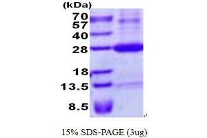 Image no. 1 for Retinoic Acid Early Transcript 1E (RAET1E) protein (His tag) (ABIN1098707) (Retinoic Acid Early Transcript 1E (RAET1E) protein (His tag))