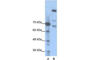 WB Suggested Anti-GLI1 Antibody Titration:  1. (GLI1 Antikörper  (N-Term))