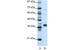 HNRPDL antibody used at 1 ug/ml to detect target protein.