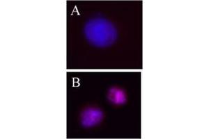 Image no. 1 for anti-Aurora Kinase B (AURKB) (pThr232) antibody (ABIN230502)