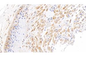 Detection of NODAL in Human Placenta Tissue using Polyclonal Antibody to Nodal Homolog (NODAL) (Nodal Antikörper  (AA 27-347))