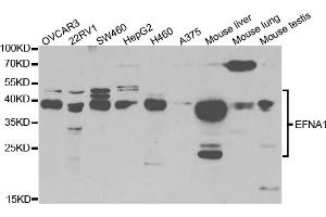 Western blot analysis of extracts of various cell lines, using EFNA1 antibody (ABIN5973078) at 1/1000 dilution. (Ephrin A1 Antikörper)