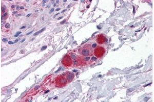 Human Small Intestine, Submucosal Plexus: Formalin-Fixed, Paraffin-Embedded (FFPE) (CDC42BPA Antikörper  (AA 2-14))