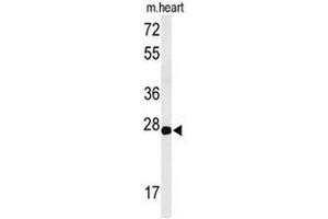 Western blot analysis of CLDN4 Antibody (C-term) in mouse heart tissue lysates (35µg/lane).