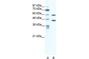 Western Blotting (WB) image for anti-Cation Channel, Sperm Associated 2 (CATSPER2) antibody (ABIN2461149) (CATSPER2 Antikörper)