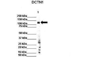 WB Suggested Anti-Dctn1 Antibody  Positive Control: Lane 1: 80ug rat brain extract Primary Antibody Dilution :  1:500 Secondary Antibody : IRDye 800 CW goat anti-rabbit from Li-COR Bioscience Secondry Antibody Dilution :  1:20,000 Submitted by: Dr. (Dynactin 1 Antikörper  (C-Term))