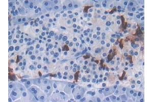 DAB staining on IHC-P; Samples: Human Pancreas Tissue (CXCL16 Antikörper  (AA 33-171))