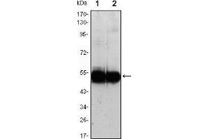 Western blot analysis using VCAM1 mouse mAb against HUVEC (1) and EC (2) cell lysate.