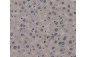 IHC-P analysis of Rat Tissue, with DAB staining. (Surfactant Protein C Antikörper  (AA 95-194))