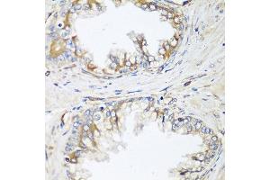 Immunohistochemistry of paraffin-embedded human prostate using HPSE2 antibody at dilution of 1:100 (40x lens). (Heparanase 2 Antikörper)