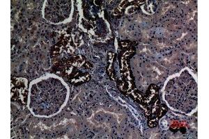 Immunohistochemistry (IHC) analysis of paraffin-embedded Human Kidney, antibody was diluted at 1:100. (RHCG Antikörper  (Internal Region))