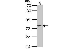 WB Image Sample (30 ug of whole cell lysate) A: A431 , 7. (MIPEP Antikörper)