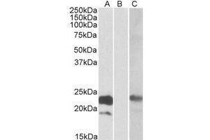 HEK293 lysate (10 µg protein in RIPA buffer) overexpressing Human CST8 with C-terminal MYC tag probed with AP21268PU-N (1ug/ml) in Lane A and probed with anti-MYC Tag (1/1000) in Lane C. (CST8 Antikörper  (Internal Region))