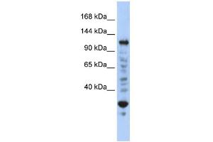 WB Suggested Anti-NFX1 Antibody Titration:  0. (NFX1 Antikörper  (N-Term))