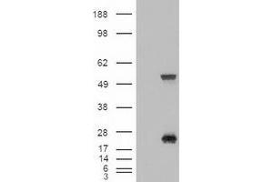 Western Blotting (WB) image for anti-Sonic Hedgehog (SHH) (AA 24-197) antibody (ABIN1491249) (Sonic Hedgehog Antikörper  (AA 24-197))