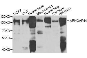 Western blot analysis of extracts of various cell lines, using ARHGAP44 antibody. (ARHGAP44 Antikörper  (AA 666-772))
