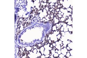 IHC testing of FFPE rat lung with Talin 1 antibody at 2ug/ml. (TLN1 Antikörper)