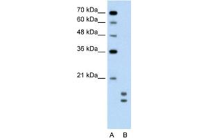WB Suggested Anti-UBE2L3 Antibody Titration:  0. (UBE2L3 Antikörper  (C-Term))