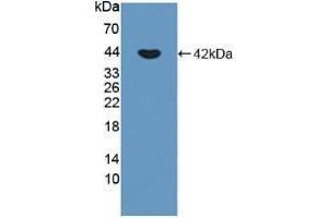 Detection of Recombinant CDHP, Human using Polyclonal Antibody to Placental Cadherin (P-cadherin) (P-Cadherin Antikörper  (AA 371-660))