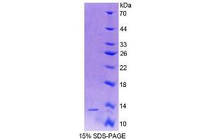 SDS-PAGE (SDS) image for Vitamin D-Binding Protein (GC) (AA 395-475) protein (His tag) (ABIN1171636) (Vitamin D-Binding Protein Protein (GC) (AA 395-475) (His tag))