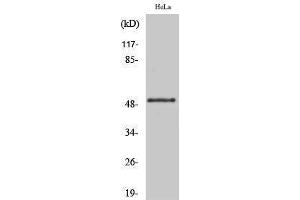 Western Blotting (WB) image for anti-Glycogen Synthase Kinase 3 alpha (GSK3a) (pSer21) antibody (ABIN3179443) (GSK3 alpha Antikörper  (pSer21))