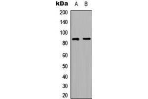 Western blot analysis of RFWD3 expression in HeLa (A), HepG2 (B) whole cell lysates. (RFWD3 Antikörper  (Center))
