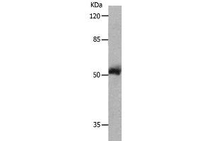 Western Blot analysis of 231 cell using MMP8 Polyclonal Antibody at dilution of 1:800 (MMP8 Antikörper)