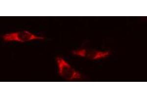 ABIN6274191 staining HeLa cells by IF/ICC. (Hexokinase 1 Antikörper  (N-Term))