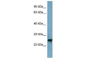 WB Suggested Anti-MRPL48 Antibody Titration: 0. (MRPL48 Antikörper  (Middle Region))