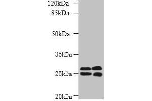 Western blot All lanes: CMBL antibody at 1 μg/mL Lane 1: Mouse kidney tissue Lane 2: Mouse liver tissue Secondary Goat polyclonal to rabbit IgG at 1/10000 dilution Predicted band size: 29 kDa Observed band size: 29, 25 kDa (CMBL Antikörper  (AA 2-245))