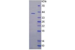 Image no. 1 for Fragile X Mental Retardation 1 (FMR1) (AA 1-314) protein (His tag) (ABIN6237577) (FMR1 Protein (AA 1-314) (His tag))