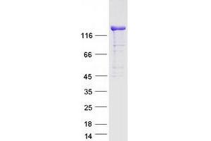 Western Blotting (WB) image for Diaphanous Homolog 1 (DIAPH1) (Transcript Variant 2) protein (Myc-DYKDDDDK Tag) (ABIN2719470)