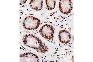 Immunohistochemical analysis of paraffin-embedded H. (RBX1 Antikörper  (C-Term))