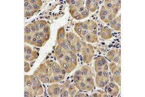 Immunohistochemical analysis of TECR staining in human liver formalin fixed paraffin embedded tissue section. (TECR Antikörper  (C-Term))