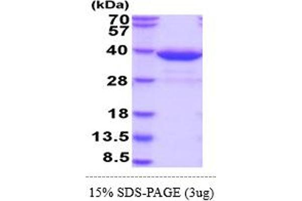 HNMT Protein (AA 1-292) (His tag)