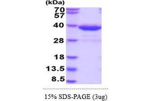 SDS-PAGE (SDS) image for Histamine N-Methyltransferase (HNMT) (AA 1-292) (Active) protein (His tag) (ABIN5855072) (HNMT Protein (AA 1-292) (His tag))
