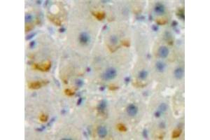 Used in DAB staining on fromalin fixed paraffin-embedded Liver tissue (CD86 Antikörper  (AA 37-272))