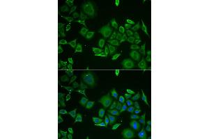 Immunofluorescence analysis of HeLa cell using C1D antibody. (C1D Antikörper)