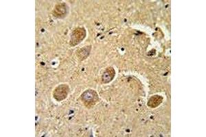 Immunohistochemistry (IHC) image for anti-Caspase 3 (CASP3) (AA 149-179) antibody (ABIN3030296)