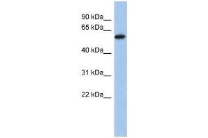 Human PANC1; WB Suggested Anti-ZNF496 Antibody Titration: 0. (ZNF496 Antikörper  (Middle Region))