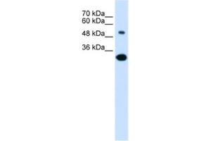 Western Blotting (WB) image for anti-Solute Carrier Family 2 (Facilitated Glucose/fructose Transporter), Member 5 (SLC2A5) antibody (ABIN2462527) (SLC2A5 Antikörper)
